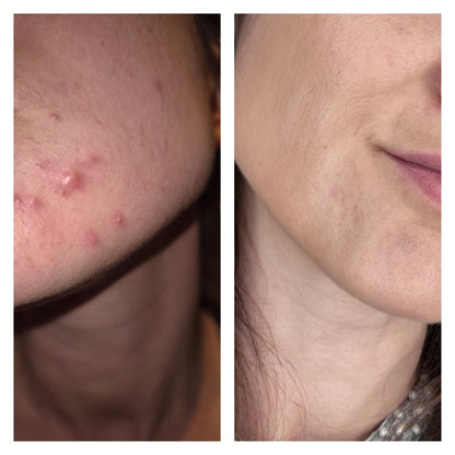 Concentré peeling AHA 30ML