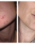 Concentré peeling AHA 30ML