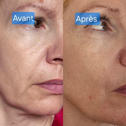 Sérum aux peptides anti-âge, 30 ml / 1.01 fl oz