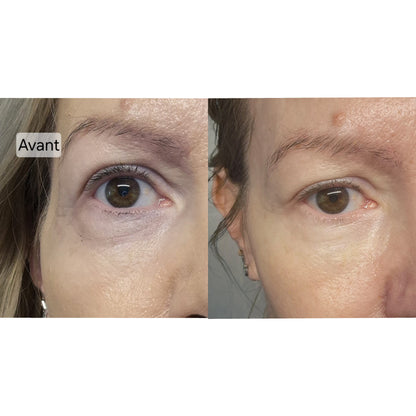 Crème contour des yeux éclaircissante anti-cerne, 15 ml / 0.51 fl oz